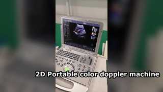 Appareil Doppler couleur portable US15 Plus 2D