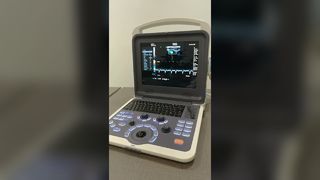 Appareil à ultrasons BR-US22