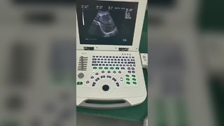Système de diagnostic par ultrasons pour ordinateur portable entièrement numérique 80 éléments BR-US11