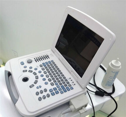 Full-Digital Laptop Ultrasound Diagnostic System 96 Element