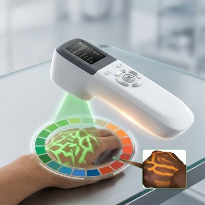 DLP Vein Finder Machine with 6000 Image Storage and 2.4 Inch LED Display for Clinical Vein Finder Device