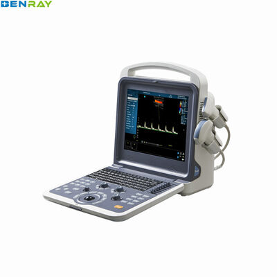 Système de diagnostic ultrasonique portatif de Doppler de couleur 80 éléments