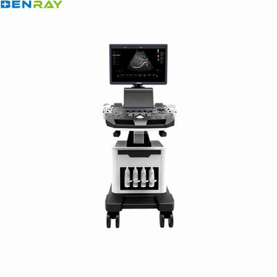 Système de diagnostic par ultrasons Doppler couleur sur chariot