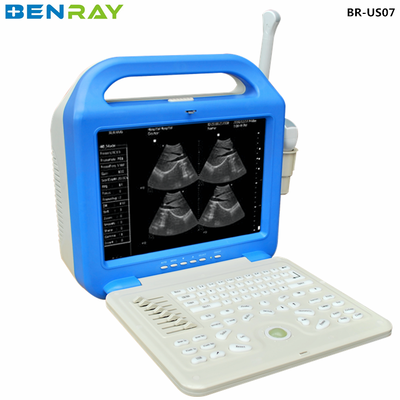 Équipement de diagnostic ultrasonique pour ordinateur portable numérique pour l'homme
