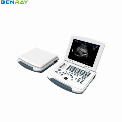 Élément du système de diagnostic par ultrasons pour ordinateur portable entièrement numérique 96