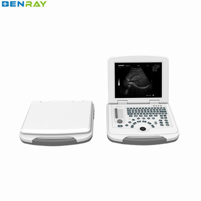 Système de diagnostic par ultrasons pour ordinateur portable entièrement numérique 80element
